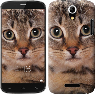 

Чохол Смугастий котик на Doogee Y100X 655473