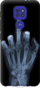 Чехол Рука через рентген для Motorola G9 Play