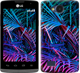

Чехол Папоротник под ультрафиолетом для LG Joy H220 609913