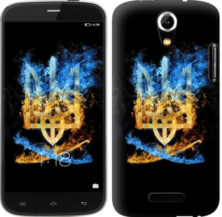 

Чехол Герб для Doogee Y100X 630684