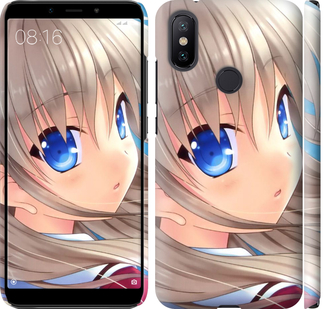 

Чехол Шарлотта для Xiaomi Mi 6X 709588