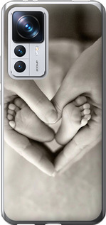 

Чохол Щира любов на Xiaomi 12T Pro 1624944