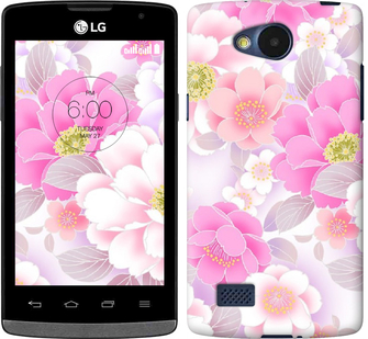 

Чохол Цвіт яблуні на LG Joy H220 432985