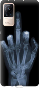 Чехол Рука через рентген для Xiaomi Civi