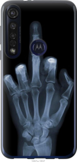 

Чохол Рука через рентген на Motorola G8 Plus 1579870