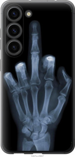 

Чохол Рука через рентген на Galaxy S23 1568082