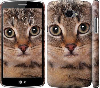 

Чохол Смугастий котик на LG K5 X220 175694