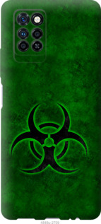 

Чехол biohazard 30 для Infinix Note 10 Pro 1425359
