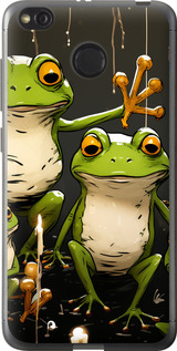 

Чехол Жабки 2 для Xiaomi Redmi 4X 1641603