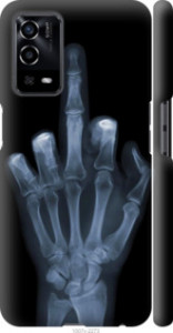 Чехол Рука через рентген для Oppo A55