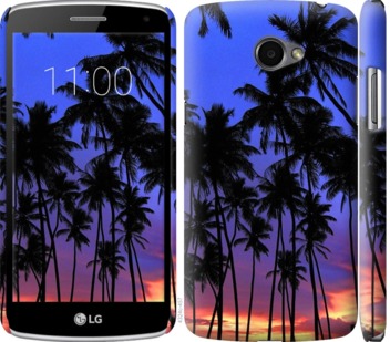 

Чехол Пальмы для LG K5 X220 759100