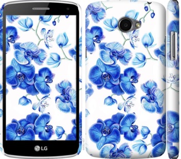 

Чехол Голубые орхидеи для LG K5 X220 725086
