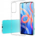 TPU чехол Epic Transparent 1,0mm для Xiaomi 12 / 12X