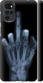 

Чехол Рука через рентген для Motorola G22 1579878