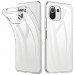 TPU чехол Epic Transparent 2,00 mm для Xiaomi Mi 11 Lite