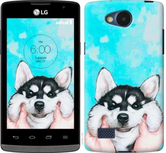 

Чехол Улыбнись для LG Joy H220 719993
