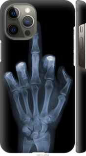 

Чехол Рука через рентген для iPhone 12 Pro Max 1567344