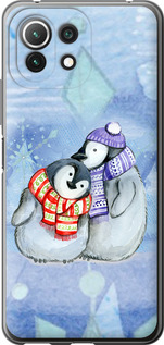 

Чехол Новогодний 5 для Xiaomi Mi 11 Lite 1682247