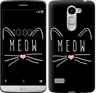 

Чохол Kitty для LG Ray 628478