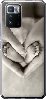 

Чехол Любовь для Xiaomi Poco X3 GT 1624953