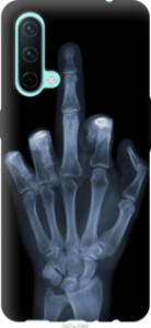 Чохол Рука через рентген на OnePlus Nord CE