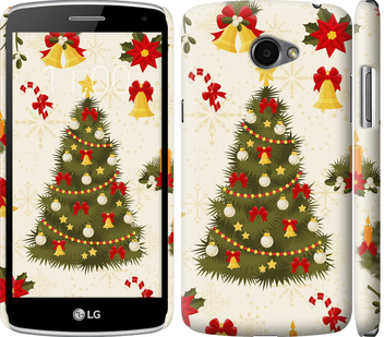 

Чохол Новорічна ялинка на LG K5 X220 450987