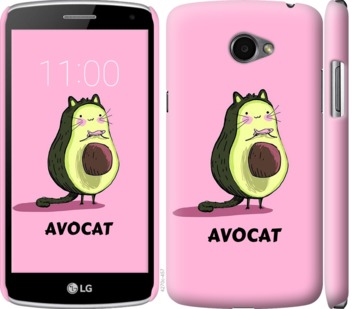 

Чехол Avocat для LG K5 X220 718726
