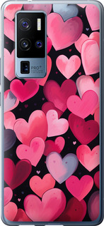 

Чехол Сердечки 4 для Vivo X50 Pro Plus 1646112