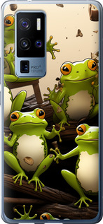 

Чохол Жабки на Vivo X50 Pro Plus 1640929