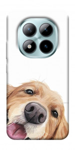 Чехол Funny dog для Xiaomi Redmi Note 15 Pro 5G