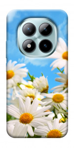 Чехол Ромашковое поле для Xiaomi Redmi Note 15 Pro+ 5G