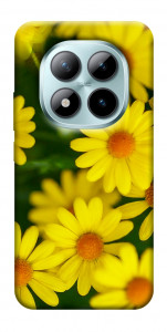 Чехол Yellow chamomiles для Xiaomi Redmi Note 15 Pro+ 5G
