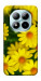 Чехол Yellow chamomiles для Xiaomi Redmi Note 15 Pro+ 5G