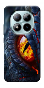 Чехол Snake eye для Xiaomi Redmi Note 15 Pro 5G