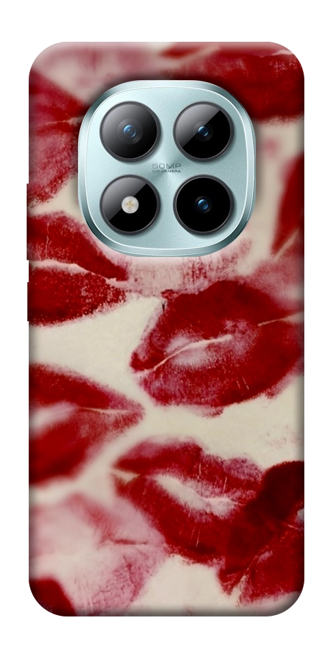 Чехол Kisses для Xiaomi Redmi Note 15 Pro 5G