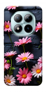 Чехол Розовый контраст для Xiaomi Redmi Note 15 Pro 5G