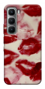 Чехол Kisses для Infinix Hot 60 Pro
