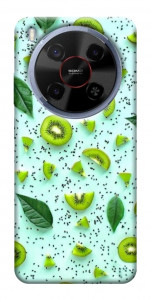 Чехол Киви для ZTE Nubia V70 Max