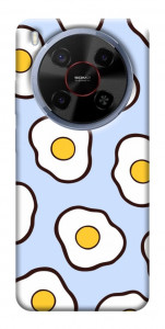 Чохол Яєчня для ZTE Nubia V70 Max