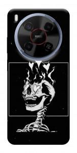 Чохол Іскрить серця для ZTE Nubia V70 Max