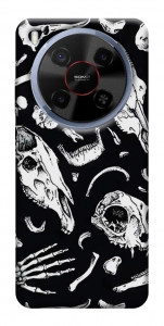Чохол Remains для ZTE Nubia V70 Max