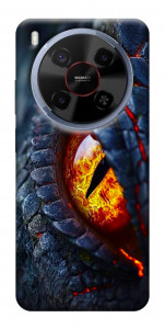 Чохол Snake eye для ZTE Nubia V70 Max