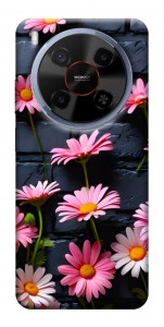 Чохол Рожевий контраст для ZTE Nubia V70 Max