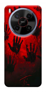 Чохол Bloody hands для ZTE Nubia V70 Max