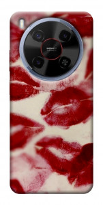 Чехол Kisses для ZTE Nubia V70 Max