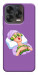 Чохол Money sleep для ZTE Nubia V70 Design