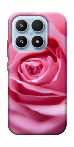 Чехол Pink bud для Xiaomi 17
