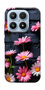 Чохол Рожевий контраст для Xiaomi 17