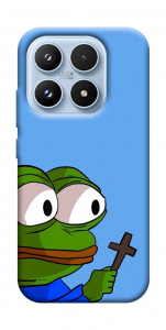 Чехол Pepe frog для Xiaomi 17