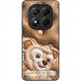 Фото TPU+PC чехол Prisma Fluffie для Xiaomi Redmi Note 14 4G (Int. version) (Dream) на vchehle.ua